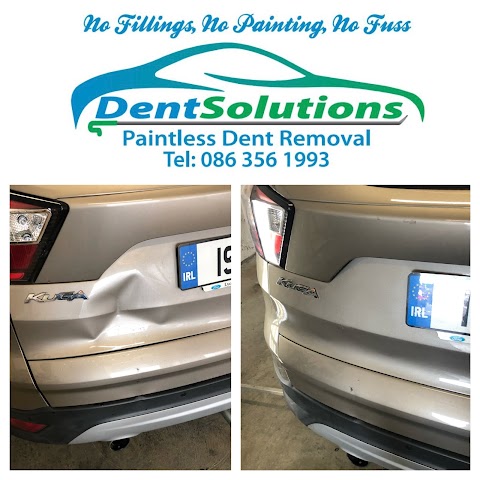 Dent Solutions