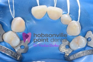 Hobsonville Point Dental