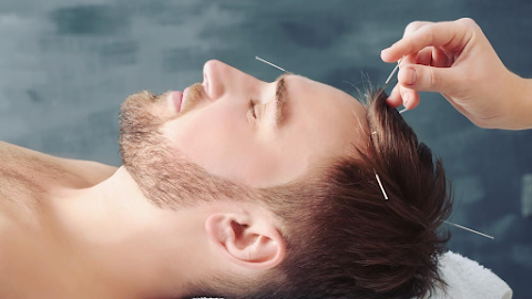 Acupuncture Nenagh - Carlos Nagliatti