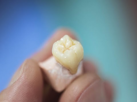 Cork Dental Smiles