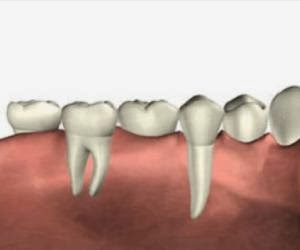 Finer Smiles Laser Dentistry