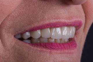 Apolonia Dental - implanty zębów, licówki, leczenie kanałowe, dentysta