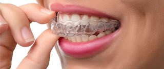 Esthetic Dental Clinic Stomatolog - Dentysta Toruń IMPLANTY wybielanie zębów - Chirurgia szczękowa