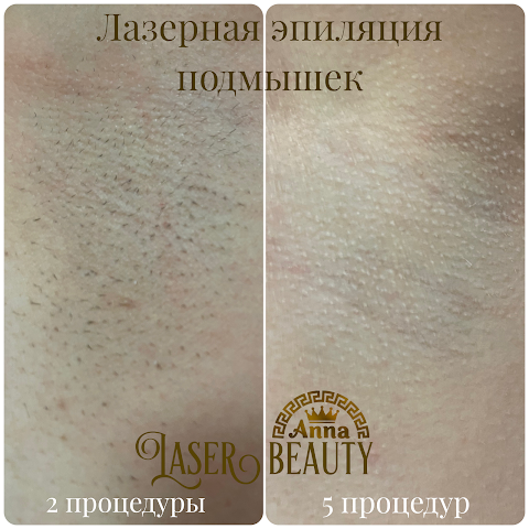 Laser Beauty Odessa