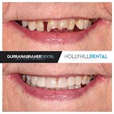 Hollyhill Dental