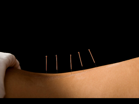 Hannah O'Connell Acupuncture