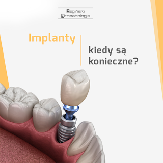 Bagiński Implantologia i Estetyka