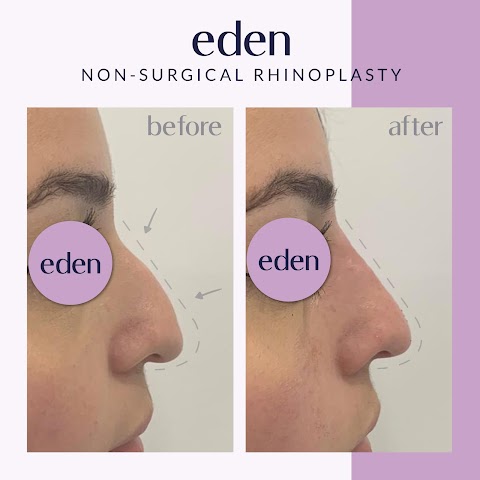 Eden Medical Kilkenny - Dermal filler, Lip filler, Anti wrinkle, Cheek filler, Jawline filler Kilkenny