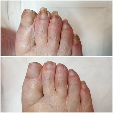 Nail & Foot Care Roscommon