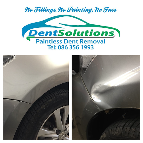 Dent Solutions