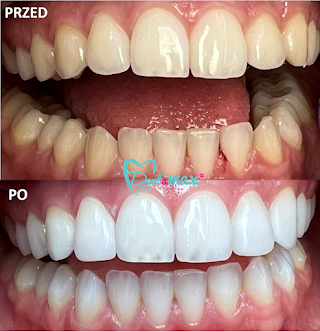 Dentamax - Dentysta, Wybielanie Zębów, Implanty Zębów - Kraków