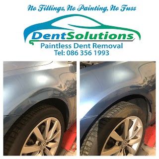 Dent Solutions