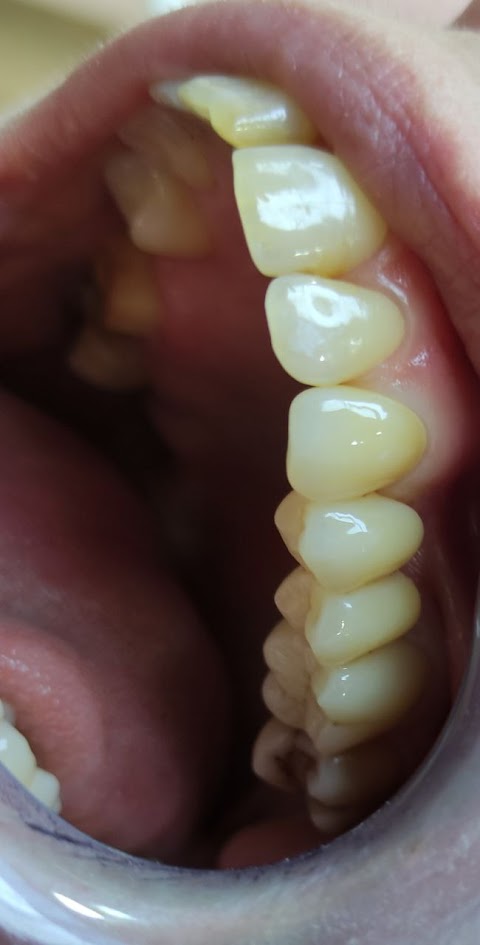 ✅LuxDent - Стоматология дантист в луцке