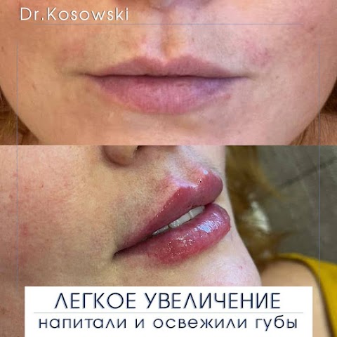 Dr.Kosowski Ботокс, Инъекционная косметология, Омоложение