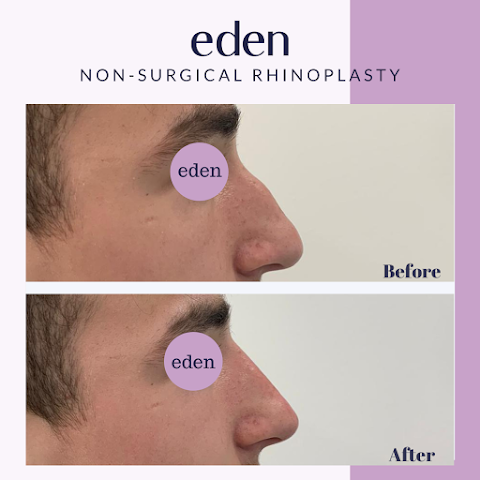 Eden Medical Kilkenny - Dermal filler, Lip filler, Anti wrinkle, Cheek filler, Jawline filler Kilkenny