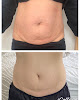 Photo of Hind's Beauty Spot - 4 Tilba Place, Woodpark NSW 2164, Australia