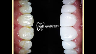 North Ryde Dentistry