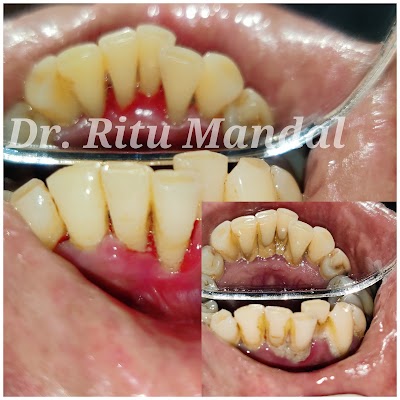 photo of Lotus Dental Care and Implant Centre | Dental Implant | Smile Designing Clinic in Kalyan