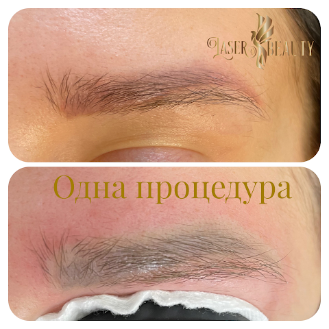 Laser Beauty Odessa