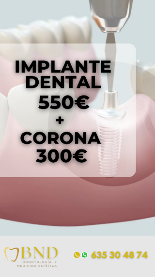 BND - Odontología y Medicina Estética en Granada
