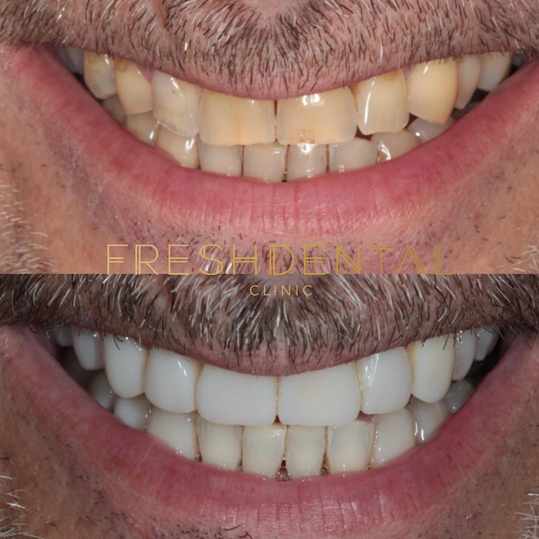 Freshdental Clinic and Institute by Monik Vasant in 46 Craven Rd, London W2 3QA, UK - Dentists featuring Restroom