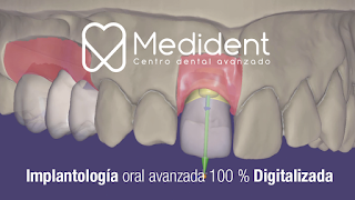 Clinica Dental Medident Torremolinos