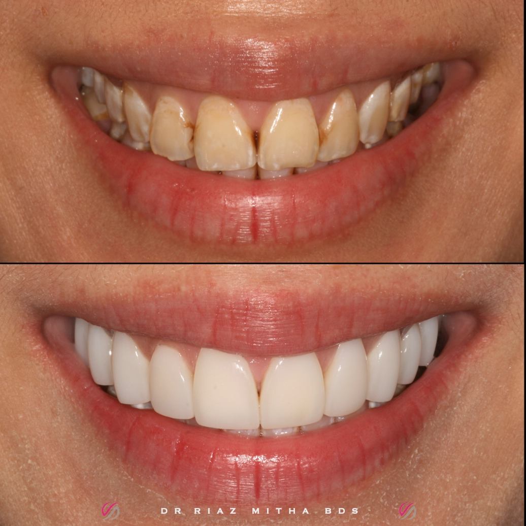 Dental Design Studio in 12 Bury Rd, Edgworth, Bolton BL7 0AY, UK - Dentists featuring Restroom