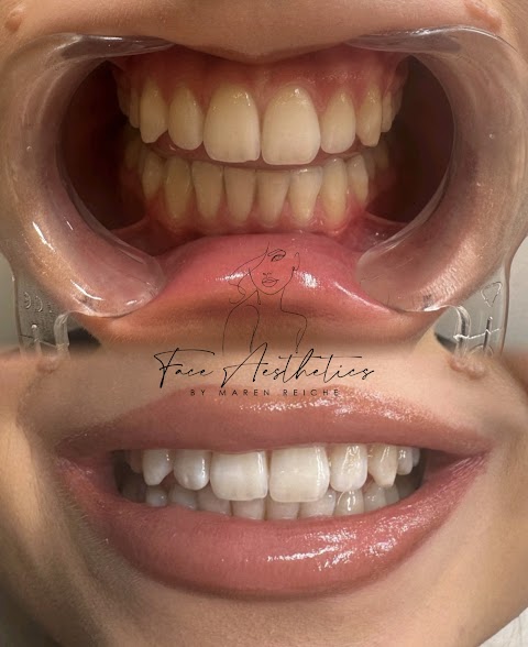 Face Aesthetics by Maren Reiche - Hildesheim