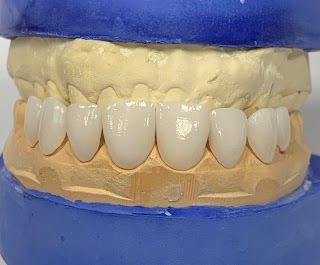 Dental Implants Cleveland