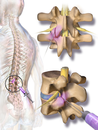 MidSouth Pain Treatment Center