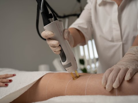 Cool Body Würzburg-Gerbrunn | Dauerhafte Haarentfernung, Microneedling & Microdermabrasion