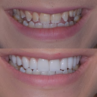 Dental Implants Cleveland