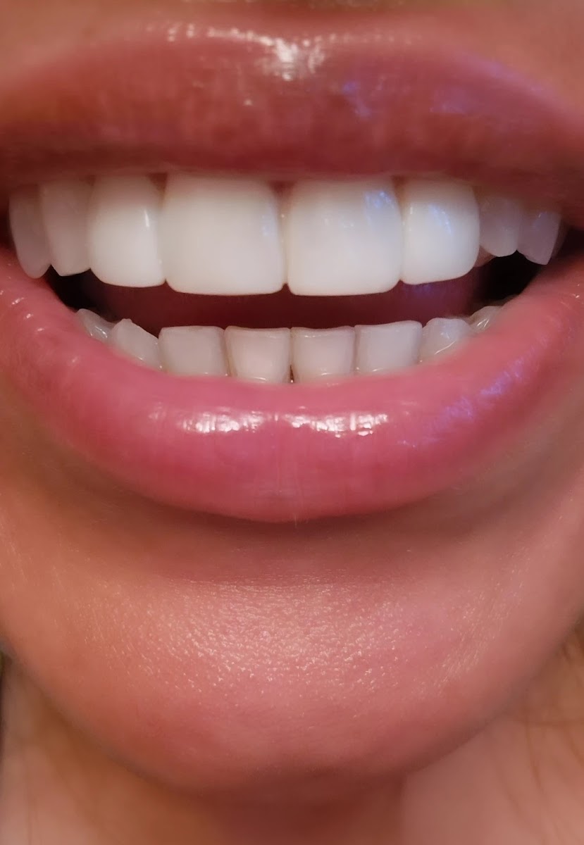 Design Dental in 34 Church St, Littleborough OL15 9AA, UK - Dentists featuring Restroom