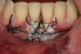 Clínica Dental Borrás