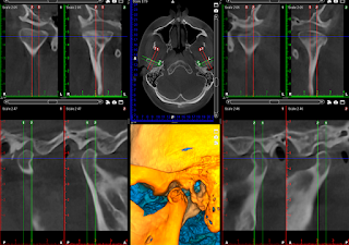 C3D PALMA MALLORCA - CENTRO DE DIAGNOSTICO AVANZADO (ODONTOLOGÍA DIGITAL)