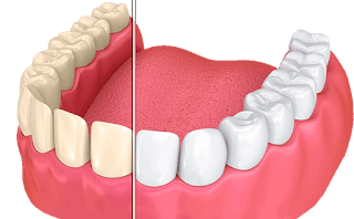 Sunrise Dental Mount Vernon