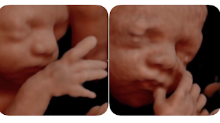 Hello Baby! 4D Ultrasound Studio