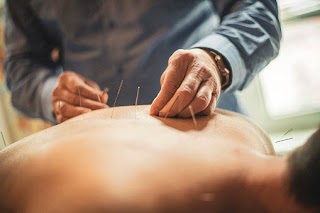 Acupuncture Clinic Deerfield