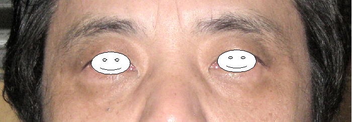 [最も欲しかった] 目の周りが黒い 167096目の周りが黒い メイク