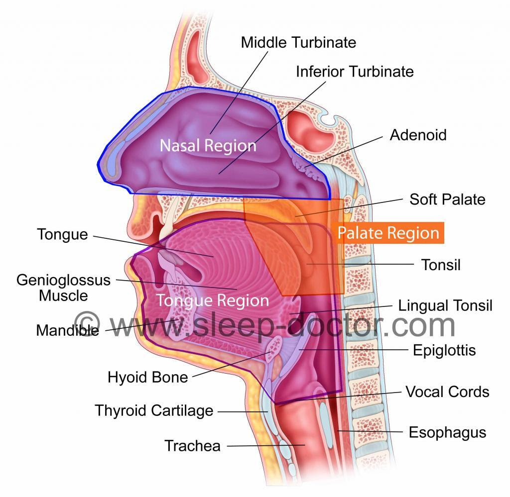 Snoring and Sleep Apnea Surgery Sleep Doctor Snoring and Sleep Apnea Surgery Sleep Doctor