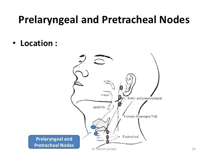 Cervical Lymph Node Swelling Kurusteleonblog