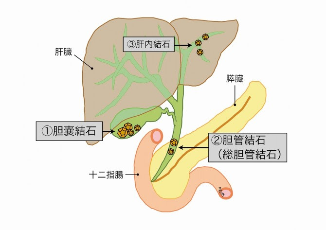 √100以上 右季肋部 痛み 419012右季肋部 痛み 食後