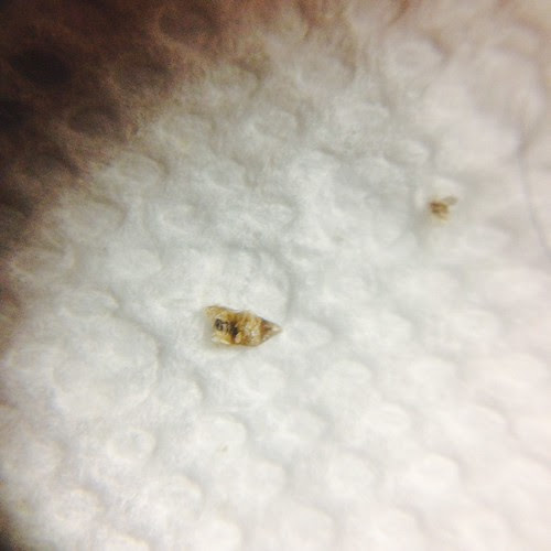 Bed Bug Pictures Identification | BangDodo