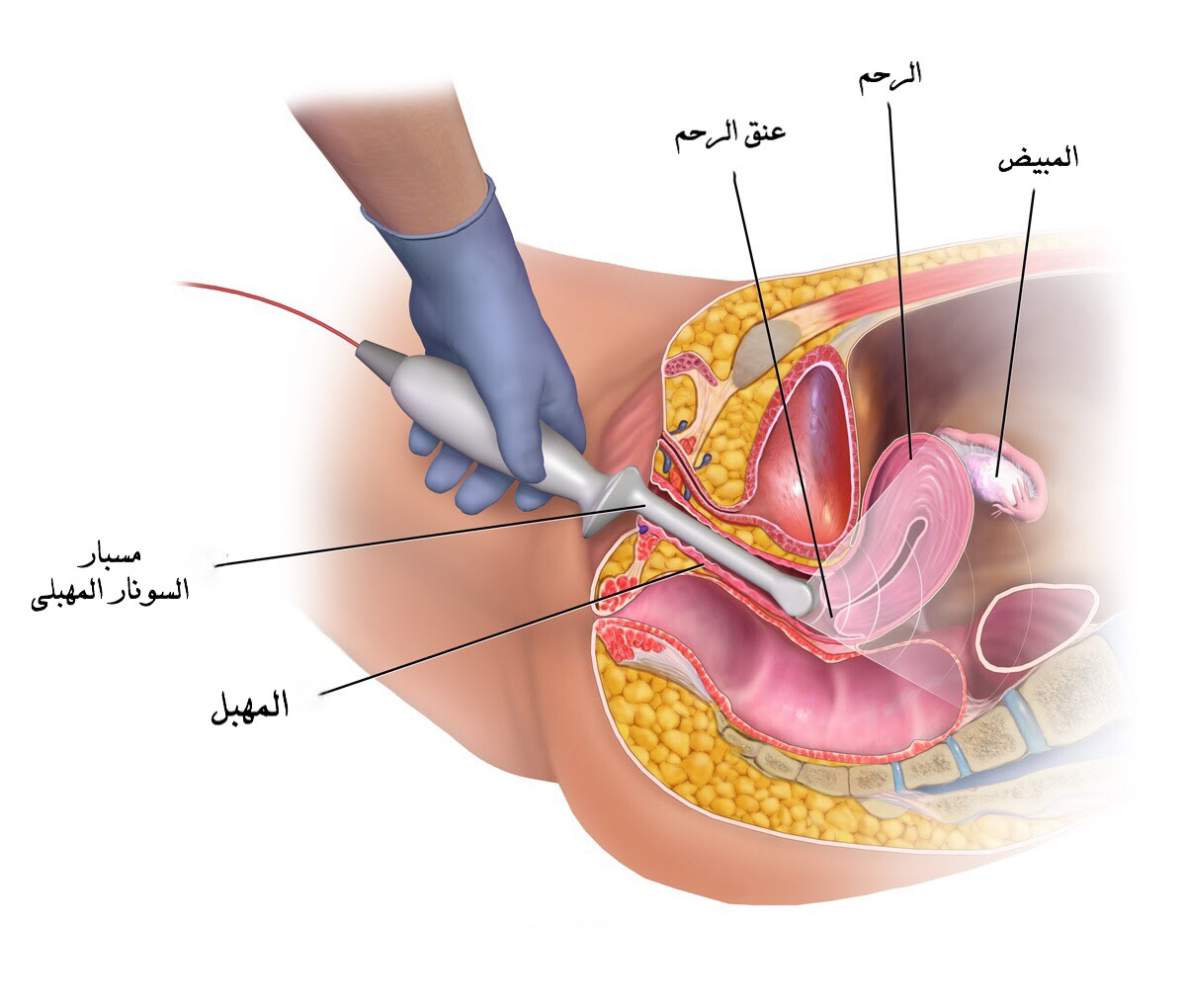 اشكال مهبل المراه تحمل