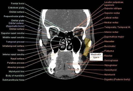 Ct Scan Facial Bone Anatomy Ct Scan Machine