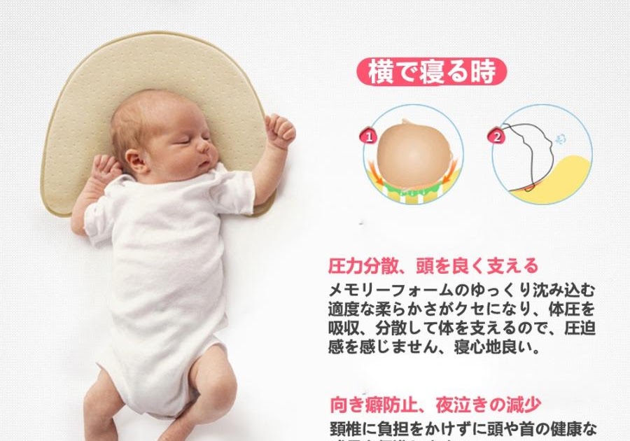 √ダウンロード 赤ちゃん 頭の形 絶壁 310300赤ちゃん 頭の形 絶壁 治し方