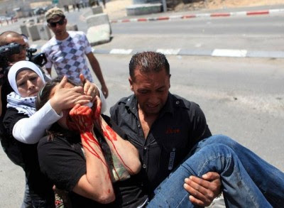 Qalandyah herido.jpg