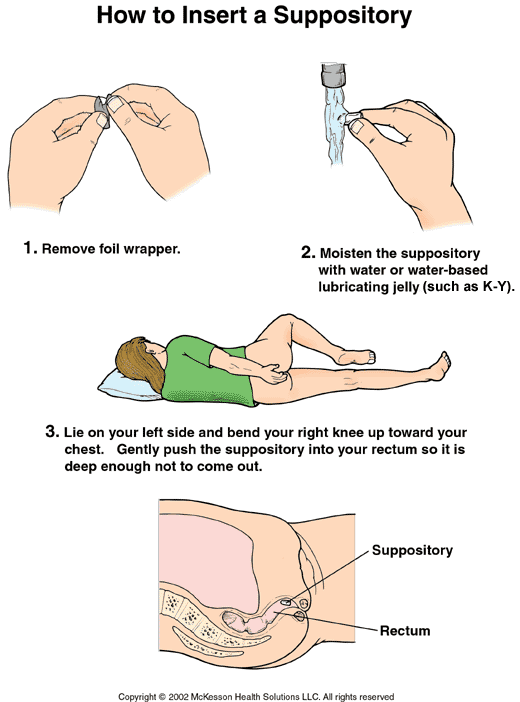 how to use a rectal suppository