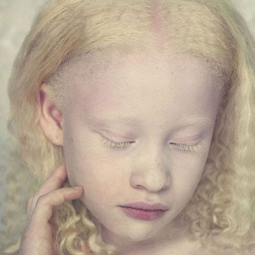 A beleza única dos albinos A beleza única dos albinos