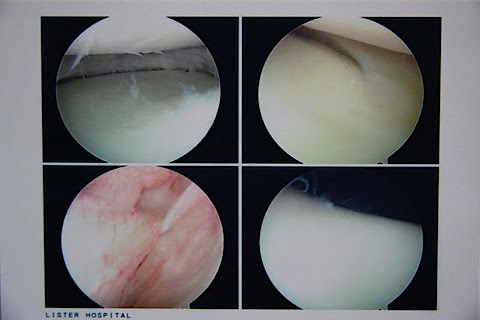 Knee Post Op.jpg